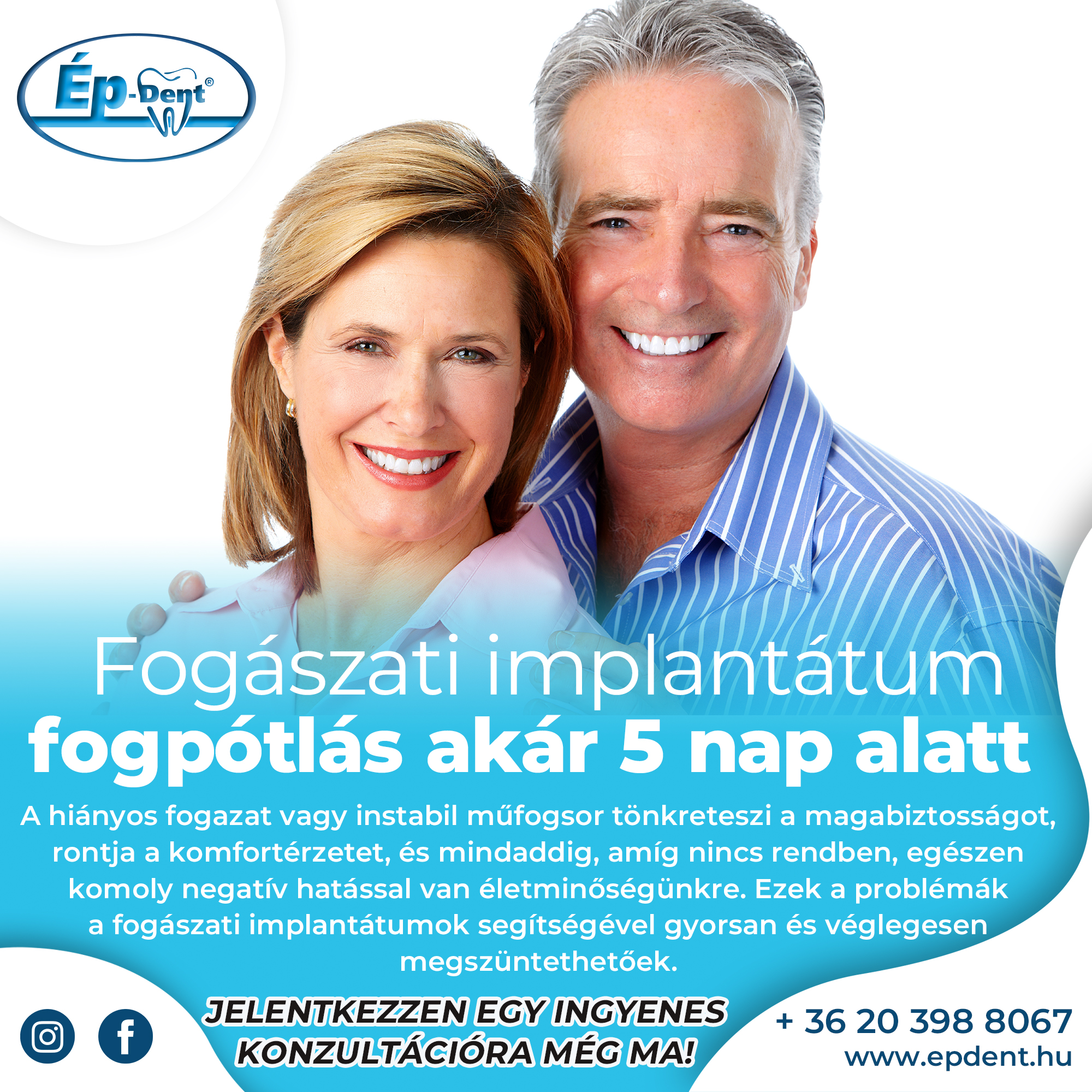 fogaszati-implantatum-akar-5-nap-alatt--Debrecen